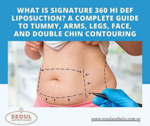 What is Signature 360 Hi Def Liposuction? A Complete Guide to Tummy, Arms, Legs, Face, and Double Ch