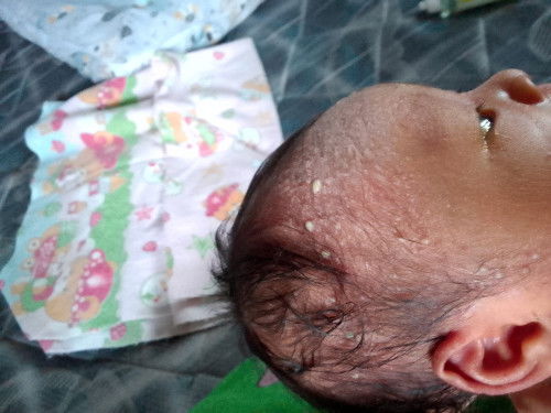 Bun mau tanya , bayi umr 8 hari bintik2 kaya gini ,ini kenapa ya ?
