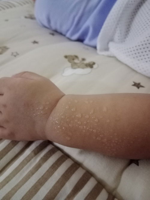 baby kuat berpeluh