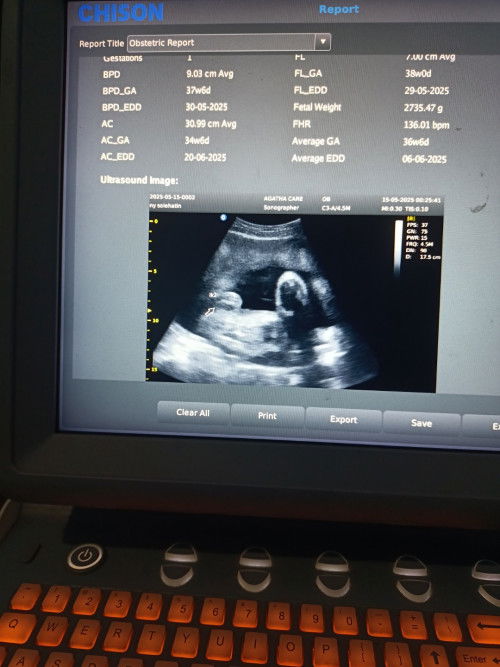 Mungkin ada bunda2 yg bsa mmbantu mngira sja 😄