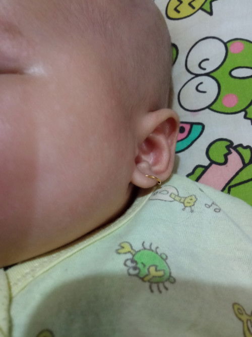 Putih putih di wajah bayi