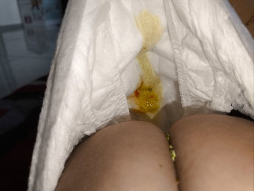 BAB BAYI 4 BULAN