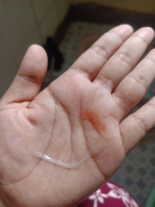 Muncul flek tapi cuman dikit, apakah tanda mau melahirkan? Usia 41 week 🥺, tapi blm kontraksi