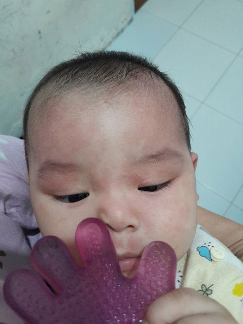 Alergi makanan bayi 6 bulan