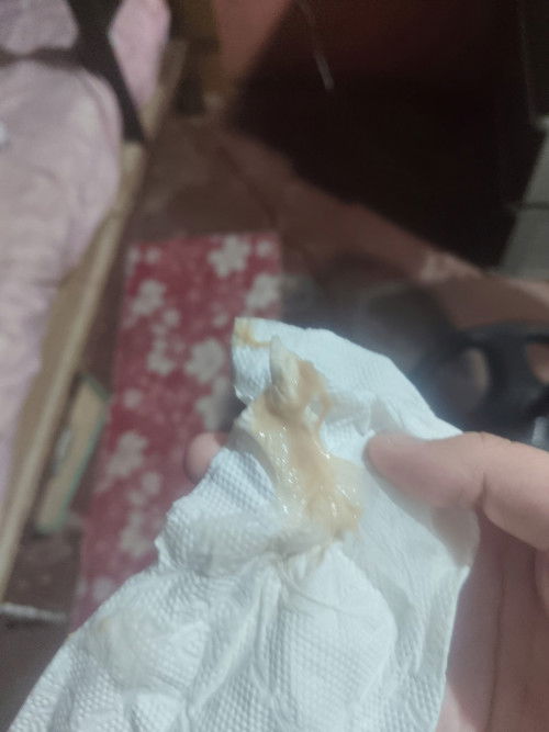 yellow with red discharge. 13 weeks pregnant