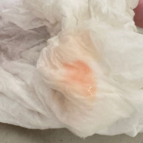 Keluar lendir darah 37w5d