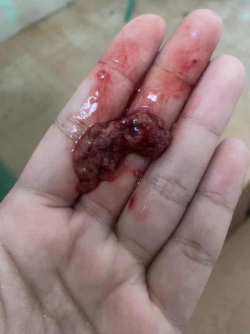 ใครรู้ช่วยบอกทีค่ะ