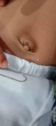Pusar bayi
