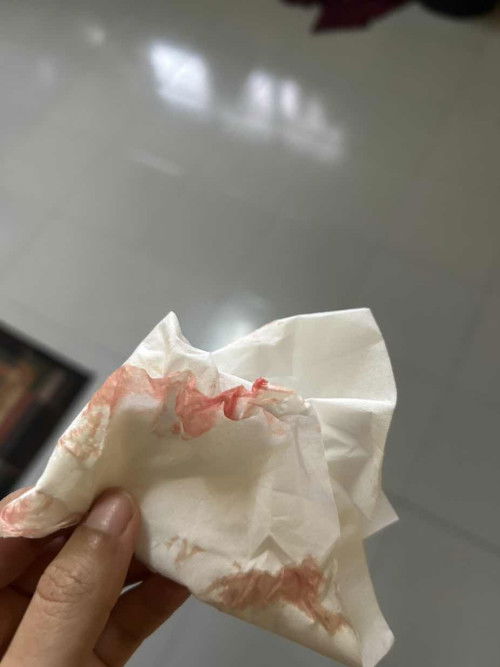 Keluar lendir darah