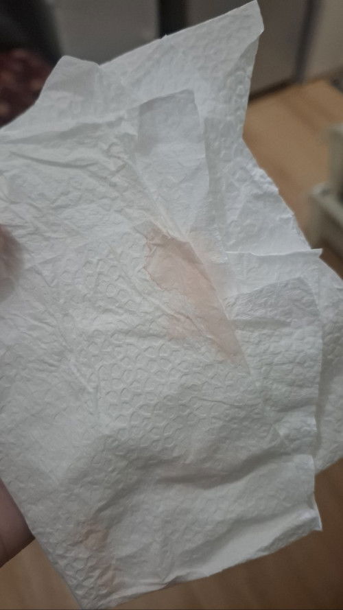 Discharge 6 weeks preggy