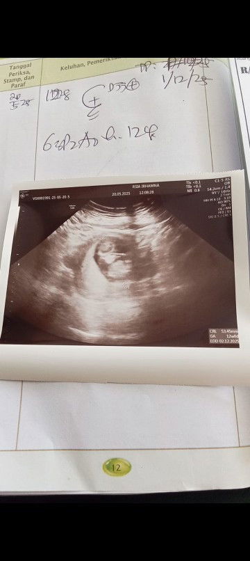 Usg 12weeks