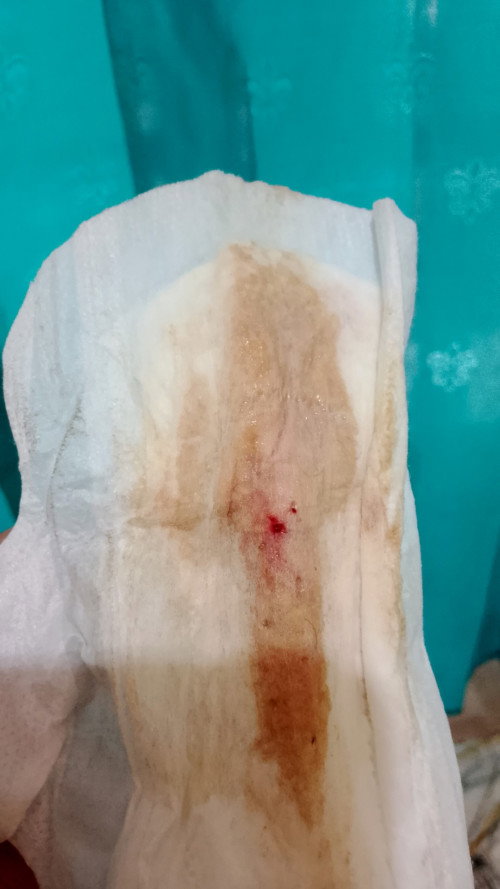 ini flek darah atau ketuban pecah dini?