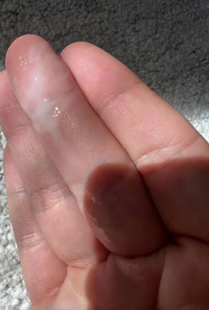 28 weeks pregnancy with white discharge