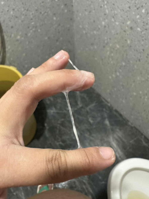 Mucus plug