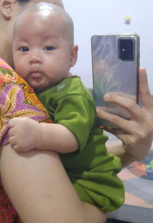 Mata bayi kecil sebelah