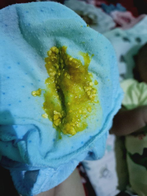 Bab bayi 3bulan setengah, seharian ini adek bab nya 4x dan kaya gini semua bund ,ini termasuk diare