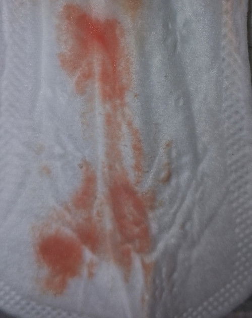MISCARRIAGE OR SPOTTING??