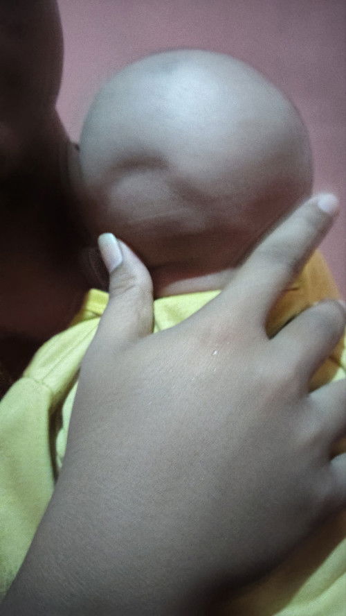 Cekungan dikepala bayi