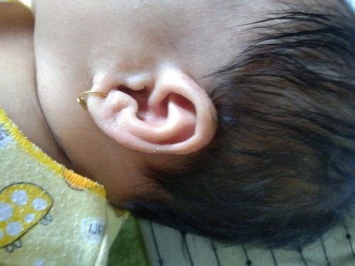 Gatal gatal dan kemerahan