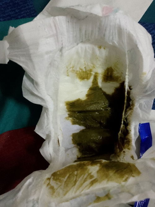 Nak tanya kalau najis warna bgini normal kah
