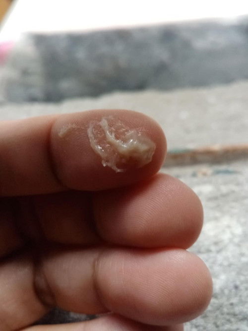 sino po naka experience ng gantong DISCHARGE?
