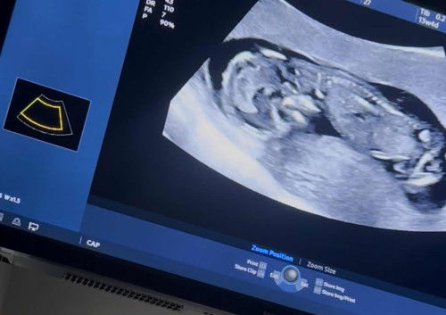 Boy or girl?