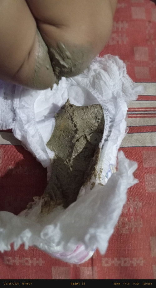 Bun klo warna pup nya kaya gini pertanda apa yh bun, kebetulan anak saya lg bapil juga?