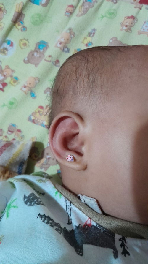 Telinga bayi merah