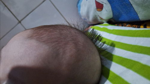Rambut bayi 2 warna berbeda dan 2 jenis rambut beda