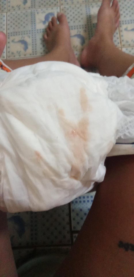 ตั้งครรภ์ได้39+5วันแล้วมีเลือดออก