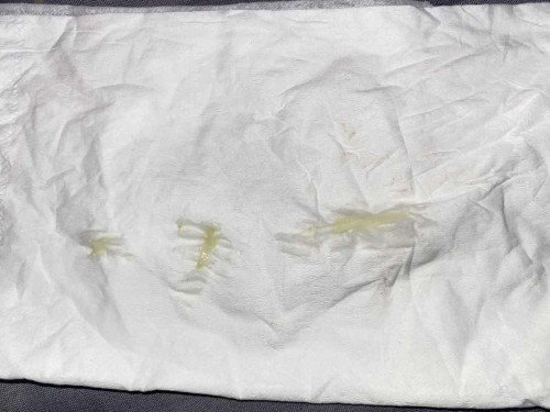 แบบนี้ปกติไหมคะ