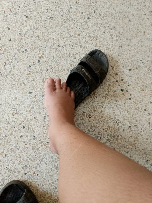 สอบถามๆแม่เท้าบวมเร็วมากๆ🥺ตอนนี้36+4 อันตรายไหมคะ