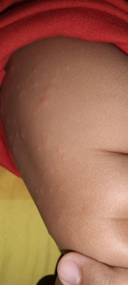 Lentingan pada bayi