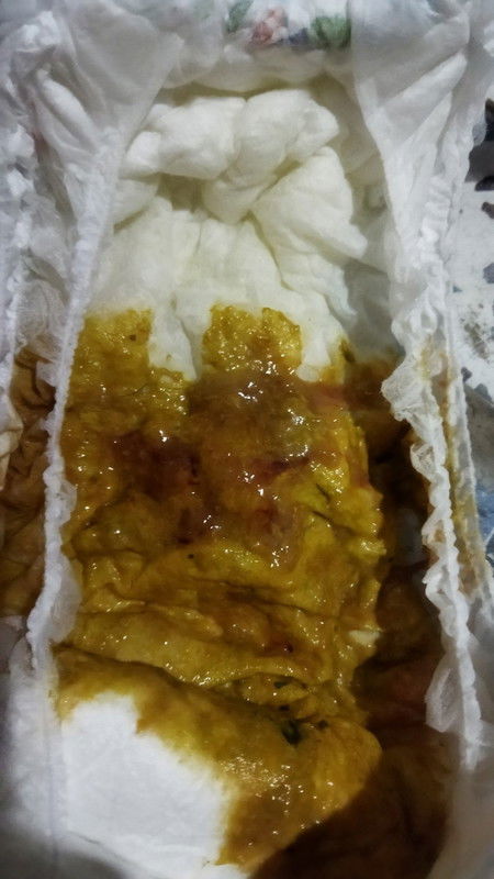 BAB lendir darah