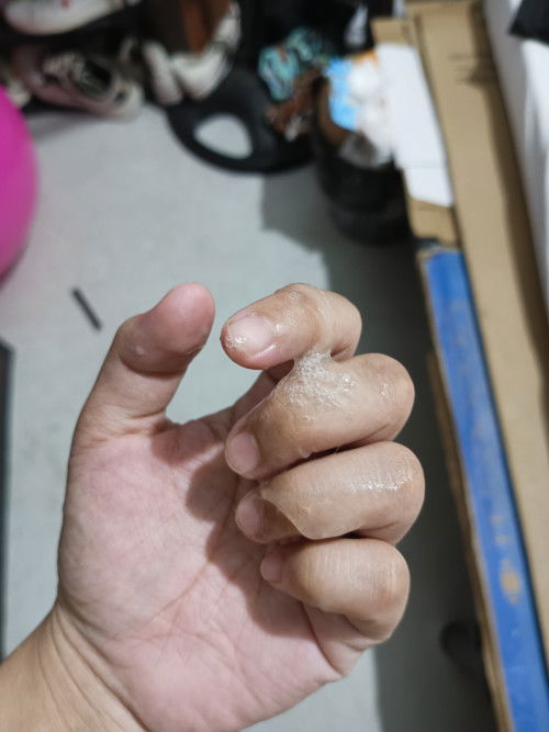 Mucus Plug?