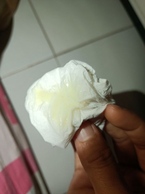 Ada yg mngalami juga ngga bun dsni , mulai 33 week kputihan sperti ini skrg 35 week tmbah banyak