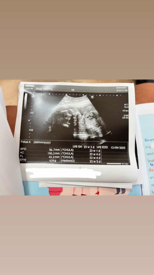 อยากทราบว่าตรงไหนคือน้องหรอค่ะ