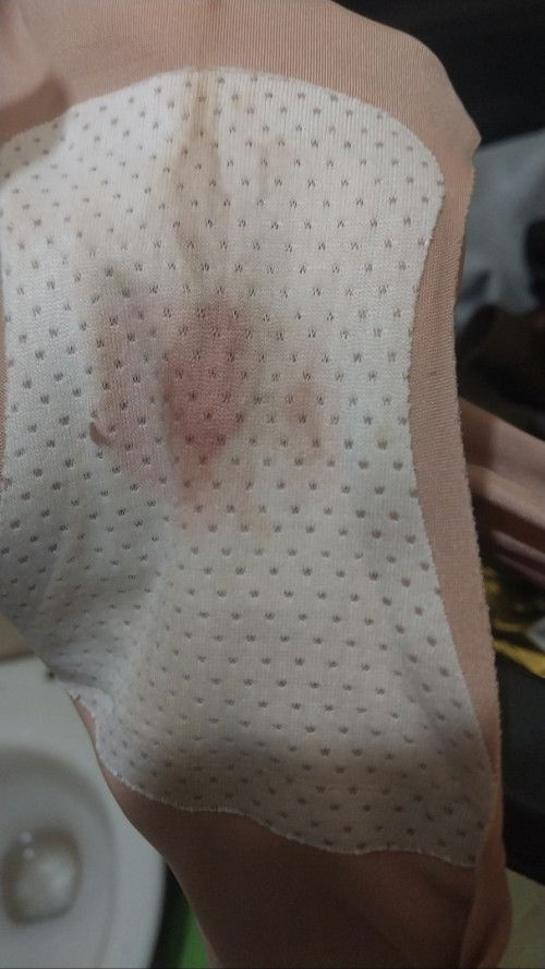 Implantation bleeding