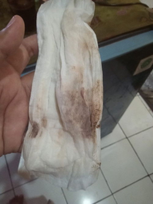 Maaf agak jorok,nhe darah coklat, pembukaan bukan iya ,tp mules nya hilang timbul,
