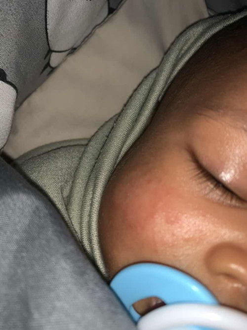 Recomendasikan skincare bayi