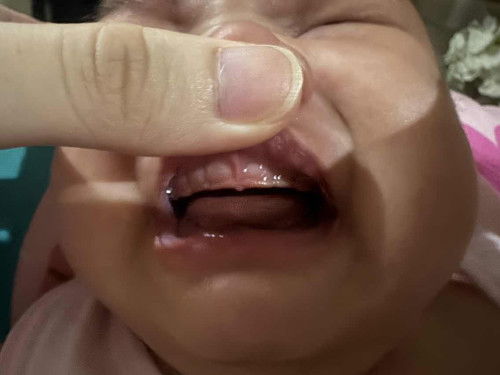 Teething at 2 months?