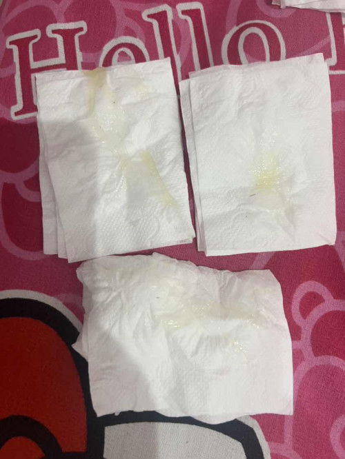 มูกสีเหลืองควรไปหาหมอเลยไหม