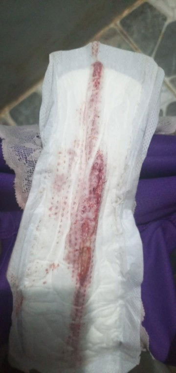 Pag po ba na IE may ksmang dugo pero wala pa daw cm at hind pa open cervix normal lng na un