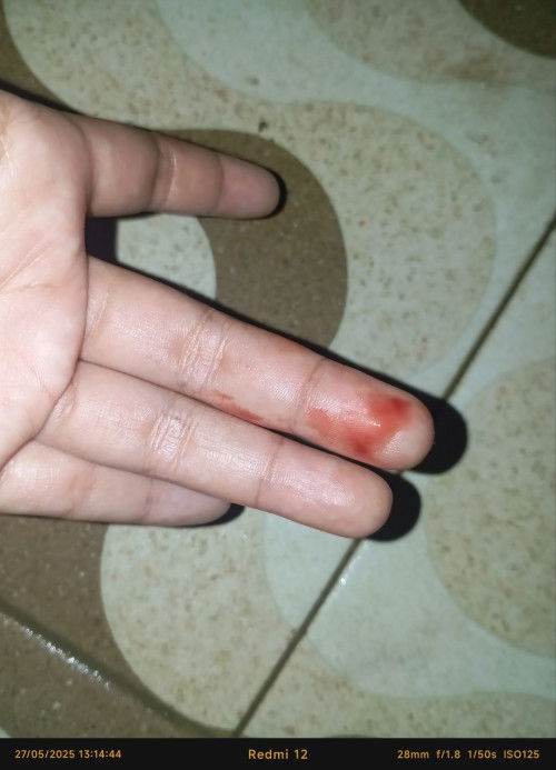 Ini flek atau apa ya Bun? Kehamilan baru 6minggu baru pertma kaya gini bntu jawab ya Bun🙏
