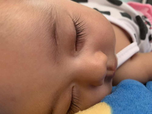 สอบถามแม่ๆว่าลูกน้อยใครเคยเป็นบ้าง น้องอายุ2เดือน18วัน