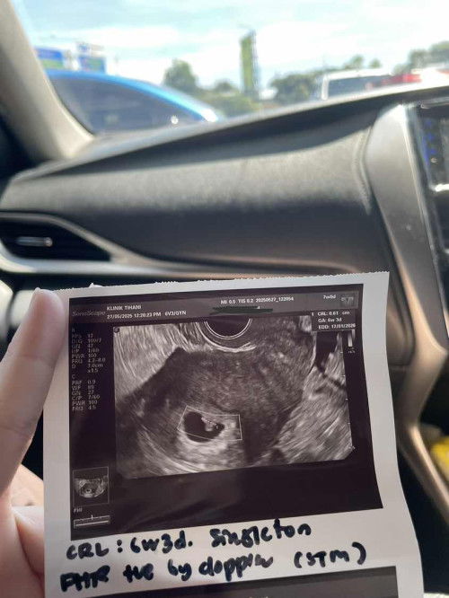 Update rainbow baby (7w)