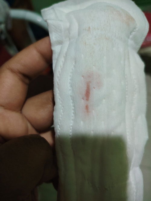 7w3d hari ni ada keluar darah sikit.. Asal mcm koko tapi hari ni darah Merah.. Risau..