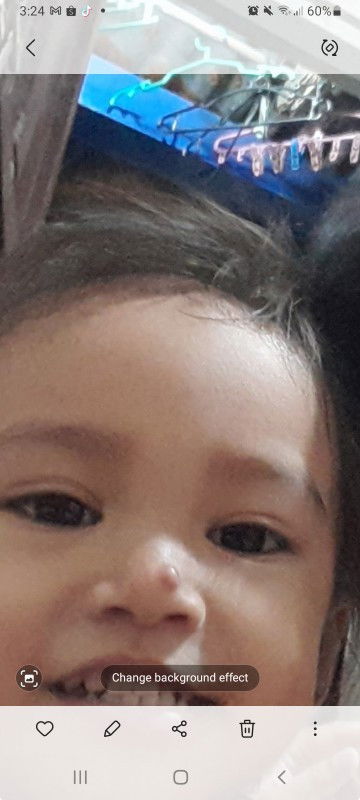 Hello mga mommies bka alam nyu po kung anu ito at owedeng igamut? May tumubo po kase sa nose ng anak