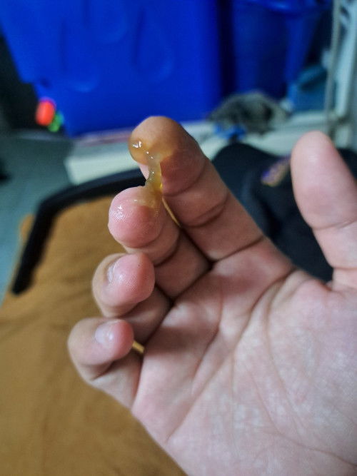 Mucus Plug?
