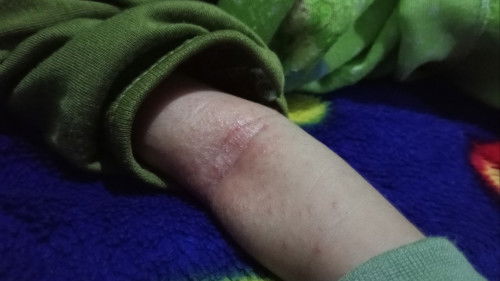 Mau nanya dong 
 kalo minum minuman manis seperti es teh manis , di trimester pertama boleh ga yah ?